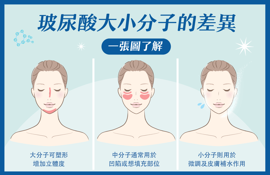 玻尿酸可用範圍