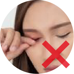 眼睛過敏